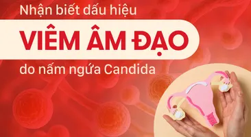 Dấu hiệu nhận biết viêm âm đạo do nấm ngứa Candida