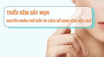Thiếu kẽm gây mụn: Nguyên nhân phổ biến và cách bổ sung kẽm hiệu quả