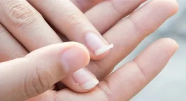 Tư vấn: Móng tay giòn dễ gãy là bệnh gì, có nguy hiểm không?