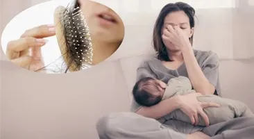 Lưu ngay cách cải thiện rụng tóc sau sinh hiệu quả nhanh