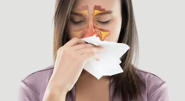 Giảm nhanh ngạt mũi do viêm xoang từ thảo dược tự nhiên