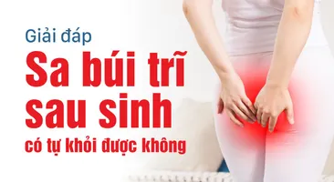 Giải đáp: Sa búi trĩ sau sinh có tự khỏi được không?
