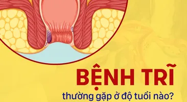 Giải đáp: Bệnh trĩ thường gặp ở độ tuổi nào?