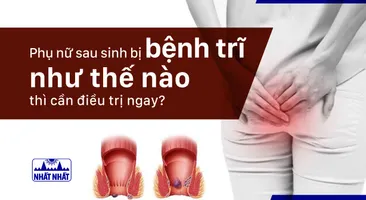 Phụ nữ sau sinh bị bệnh trĩ như thế nào thì cần điều trị ngay?