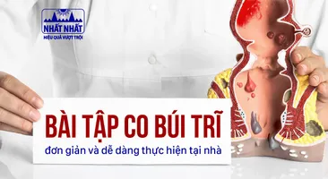 Các bài tập co búi trĩ đơn giản và dễ dàng thực hiện tại nhà
