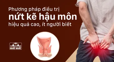 Phương pháp điều trị nứt kẽ hậu môn hiệu quả cao, ít người biết