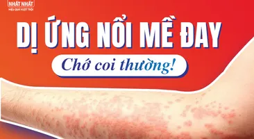 Dị ứng nổi mề đay: Chớ coi thường!