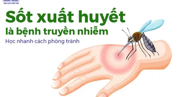 Sốt xuất huyết là bệnh truyền nhiễm: Học nhanh cách phòng tránh