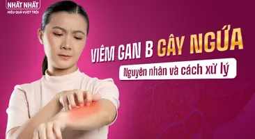 Viêm gan B gây ngứa: Phân tích nguyên nhân và cách xử lý hiệu quả nhất