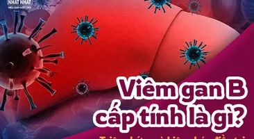 Viêm gan B cấp tính là gì? Triệu chứng và biện pháp điều trị bệnh