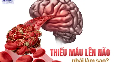 Giải đáp ngay: Thiếu máu lên não phải làm sao?