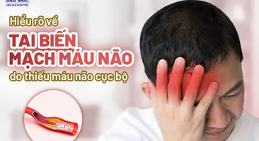 Hiểu rõ về tai biến mạch máu não do thiếu máu não cục bộ