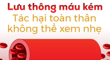 Lưu thông máu kém: Tác hại toàn thân không thể xem nhẹ
