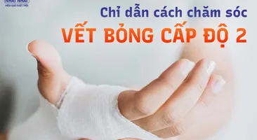 Chỉ dẫn cách chăm sóc vết bỏng cấp độ 2 tại nhà