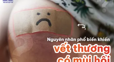 Những nguyên nhân phổ biến khiến vết thương có mùi hôi
