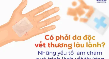 Có phải da độc vết thương lâu lành? Những yếu tố làm chậm quá trình lành vết thương