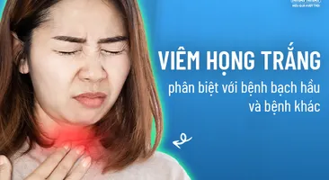 Viêm họng trắng – phân biệt với bệnh bạch hầu và bệnh khác