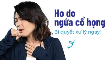 Ho do ngứa cổ họng: Bí quyết xử lý ngay!