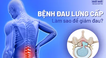 Bệnh đau lưng cấp: Làm sao để giảm nhanh cơn đau dữ dội?