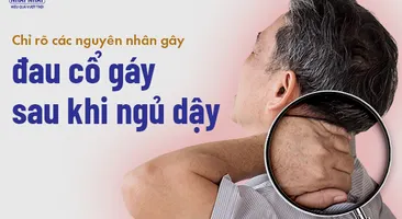 Chỉ rõ các nguyên nhân gây đau cổ gáy sau khi ngủ dậy