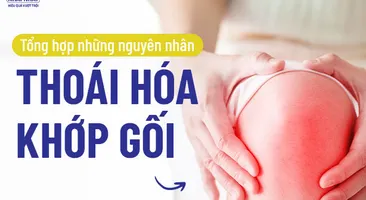 Tổng hợp những nguyên nhân thoái hóa khớp gối 