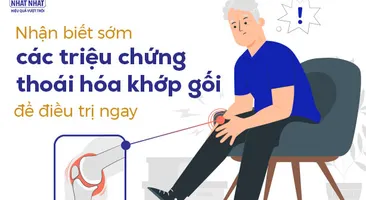 Nhận biết sớm các triệu chứng thoái hóa khớp gối để điều trị ngay