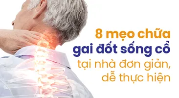 8 mẹo chữa gai đốt sống cổ tại nhà đơn giản, dễ thực hiện