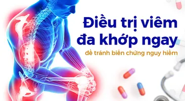 Điều trị viêm đa khớp ngay để tránh biến chứng nguy hiểm