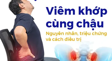 Viêm khớp cùng chậu: Nguyên nhân, triệu chứng và cách điều trị