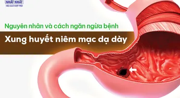 Tìm hiểu nguyên nhân và cách ngăn ngừa bệnh xung huyết niêm mạc dạ dày