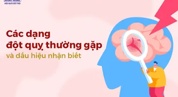 Các dạng đột quỵ thường gặp và dấu hiệu nhận biết đột quỵ