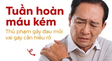 Tuần hoàn máu kém – Thủ phạm gây đau mỏi vai gáy cần hiểu rõ