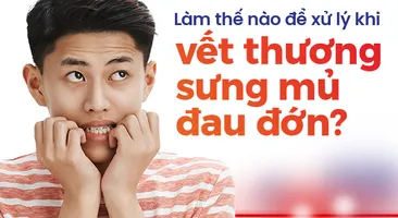 Làm thế nào để xử lý khi vết thương sưng mủ đau đớn?