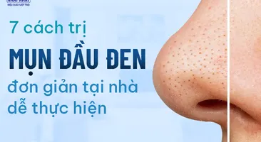 7 cách trị mụn đầu đen đơn giản tại nhà dễ thực hiện