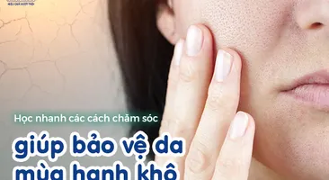 Học nhanh các cách chăm sóc giúp bảo vệ da mùa hanh khô 