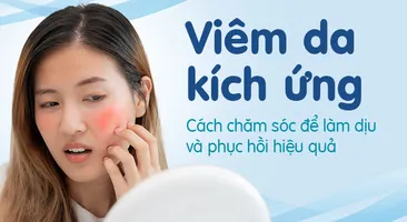 Viêm da kích ứng: Cách chăm sóc để làm dịu và phục hồi hiệu quả