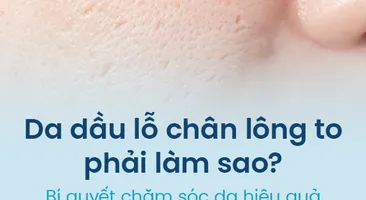 Da dầu lỗ chân lông to phải làm sao? Bí quyết chăm sóc da hiệu quả