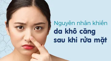 Nguyên nhân khiến da khô căng sau khi rửa mặt 