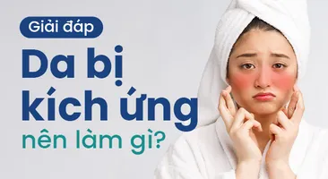Giải đáp: Da bị kích ứng nên làm gì?