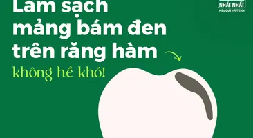 Làm sạch mảng bám đen trên răng hàm không hề khó!