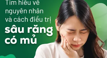 Tìm hiểu về nguyên nhân và cách điều trị sâu răng có mủ