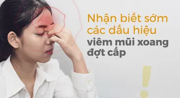 Nhận biết sớm các dấu hiệu viêm mũi xoang đợt cấp