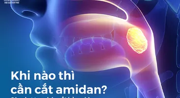 Khi nào thì cần cắt amidan? Cách phương pháp cắt bỏ amidan hiện nay