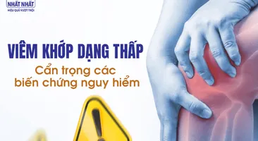 Viêm khớp dạng thấp: Cẩn trọng các biến chứng nguy hiểm