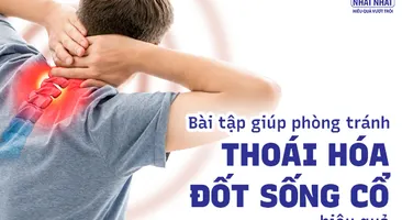Những bài tập vận động cột sống cổ giúp phòng tránh thoái hóa hiệu quả