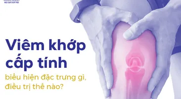 Viêm khớp cấp tính có biểu hiện đặc trưng gì, điều trị thế nào?