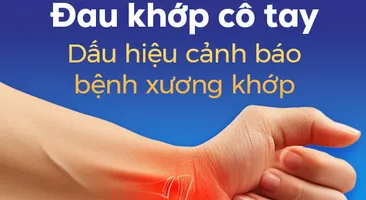 Đau khớp cổ tay: Dấu hiệu cảnh báo bệnh xương khớp