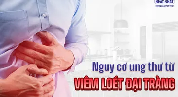 Nguy cơ ung thư từ viêm loét đại tràng: Chớ chủ quan!