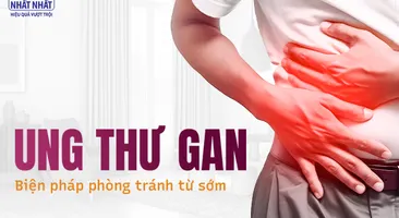 Ung thư gan: Các biện pháp phòng tránh ngay từ sớm nên thực hiện ngay