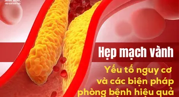 Hẹp mạch vành: Yếu tố nguy cơ và các biện pháp phòng bệnh hiệu quả
